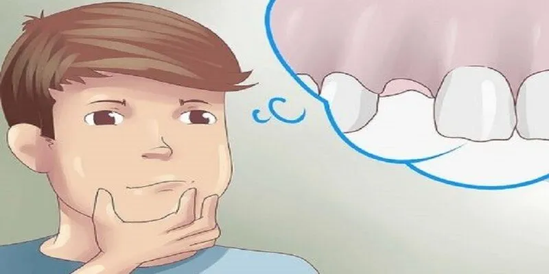 Giải đáp những tình huống khi mơ về rụng răng